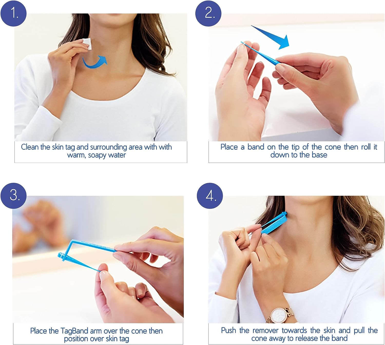 Original TagBand® - Skin Tag Removal Kit - Tagband UK