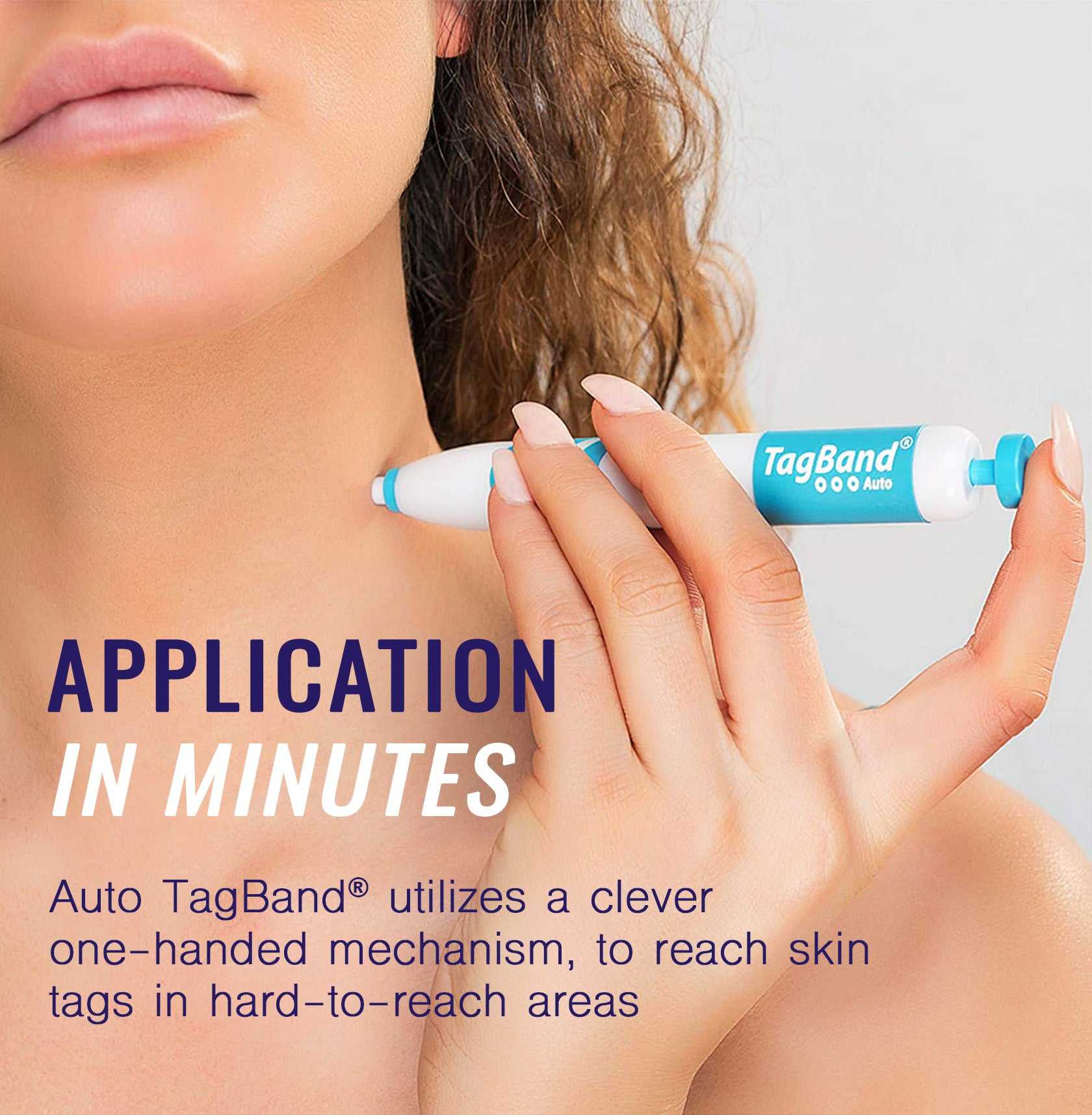 Auto Tag Fix Auto TagBand® - Skin Tag Removal Kit – Tagband UK