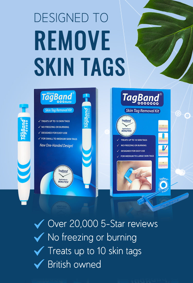TagBand Skin Tag Removal Device Tagband UK Official TagBand Skin Tag Removal Device Tagband UK Official