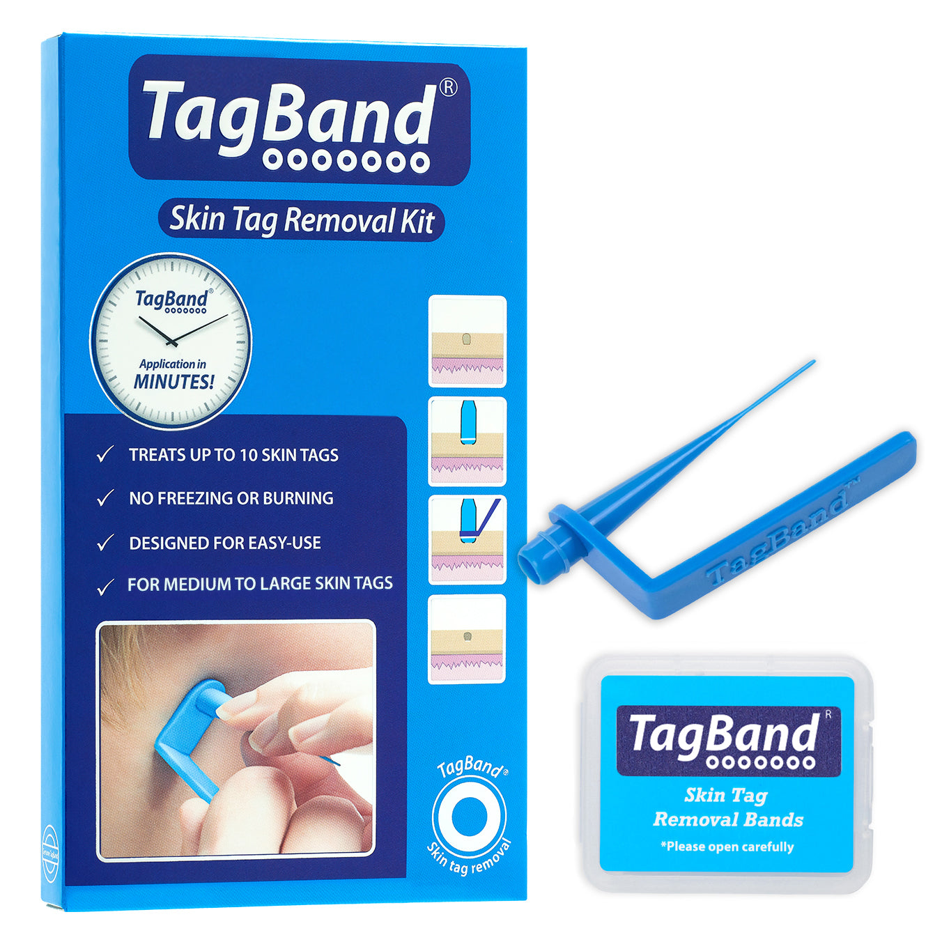 Original TagBand® - Skin Tag Removal Kit – Tagband UK